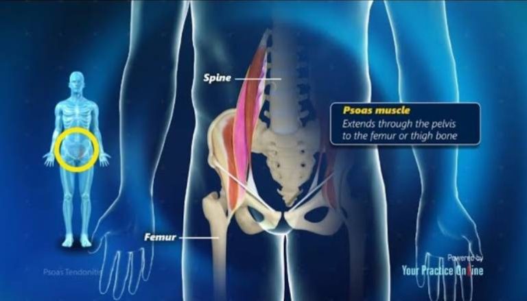 What Causes Inflammation Of The Psoas Muscle?