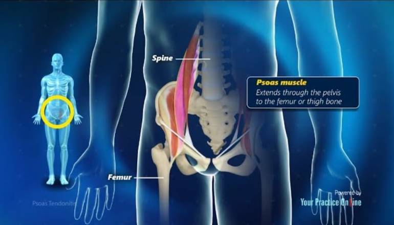 What Causes Inflammation Of The Psoas Muscle