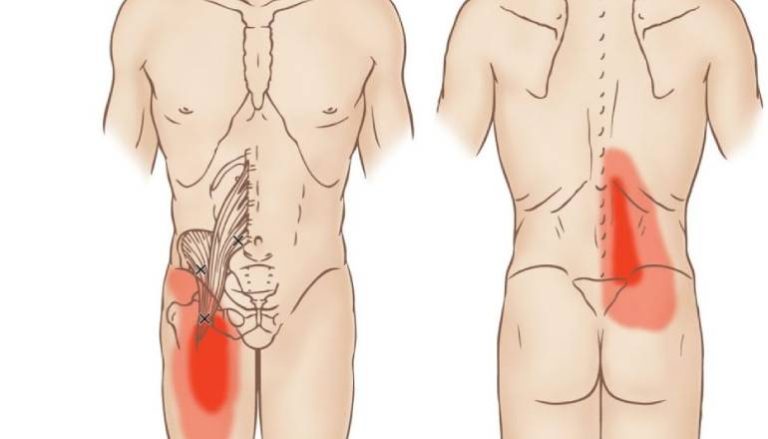 The Truth About the Psoas Muscle: Is It Really a Hip Flexor?