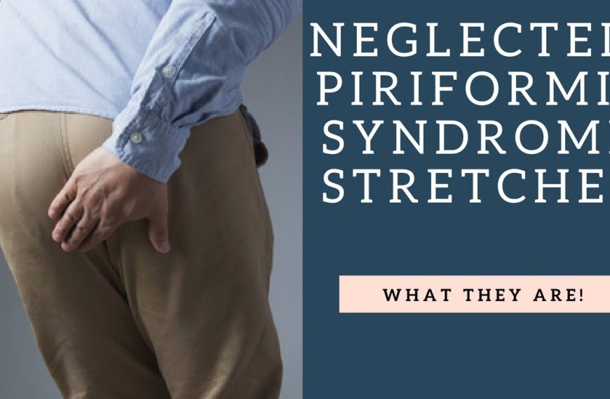 What Do Tight Hip Flexors Cause? Piriformis Syndrome: Explanation & Prevention