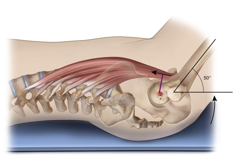 Muscles Involved in Hip Flexion: Understanding Function and Exercises